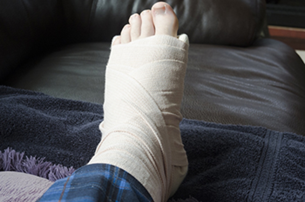 Understanding Broken Foot Injuries